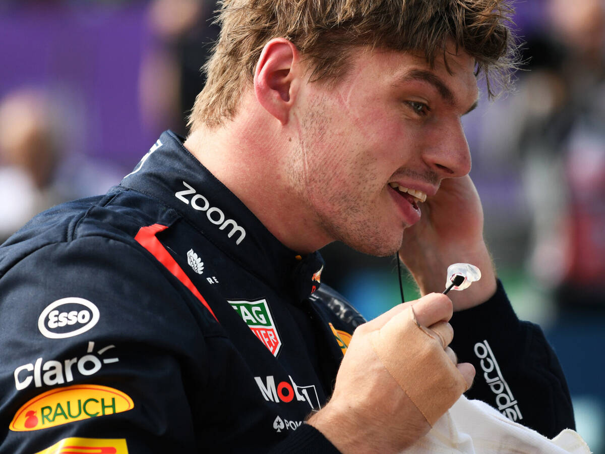 Foto zur News: Pflaster an der Hand: Max Verstappen gibt Verletzung zu